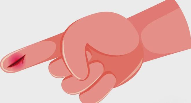 始于细节守护健康重在行动小伤口大烦恼——科学防治